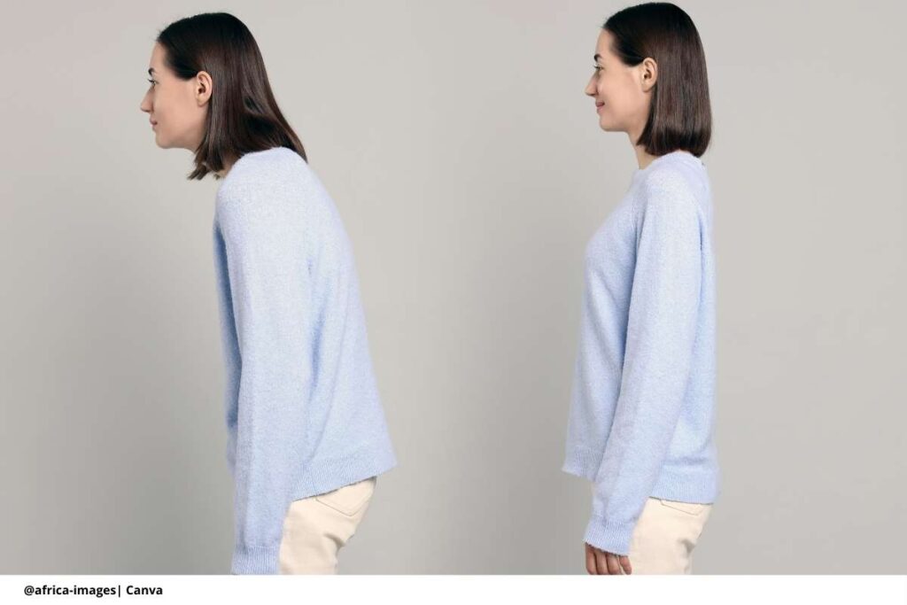 ejercicios para corregir la postura